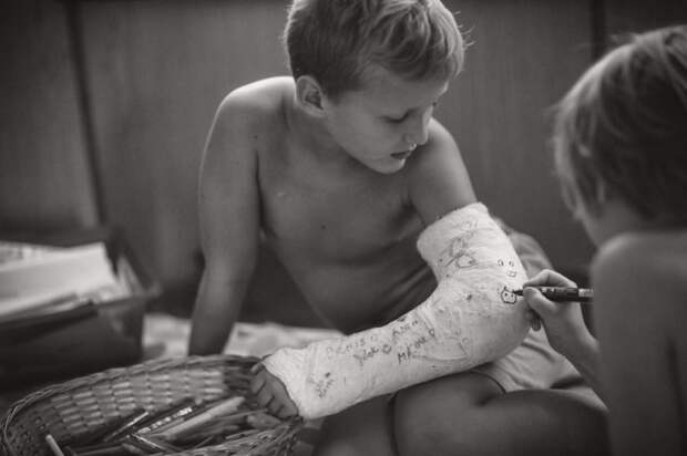 niño con una ferúla en el brazo mientras otro niño se lo firma con un plumon 