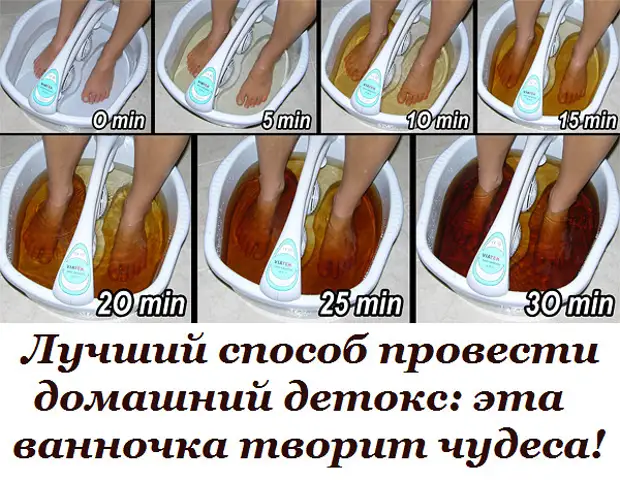 Как снять отечность с ног быстро в домашних условиях. Народные средства при отеках ног. Отеки на ногах способы избавления. Как быстро убрать отекшие ноги. Как быстро убрать отекшие ноги.