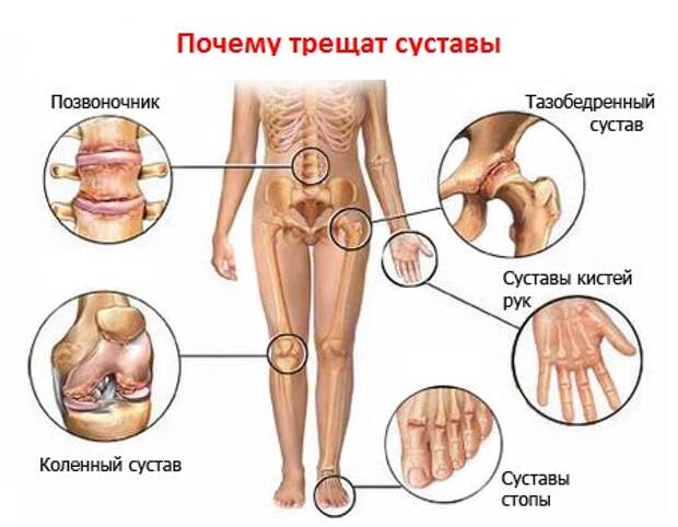 Болезни суставов, народная медицина хрящи. Болезни суставов, народная медицина хрящи.