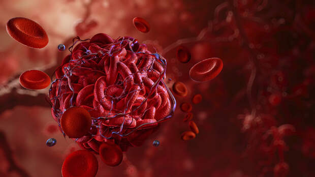 Врач Демьяновская назвала первые признаки оторвавшегося тромба