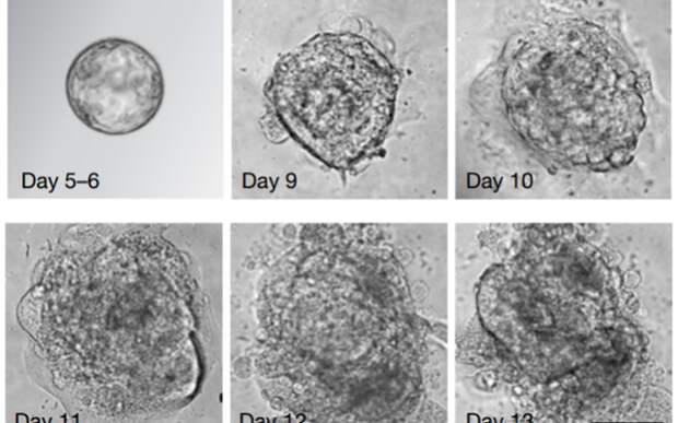 Эмбрионы на разных стадиях развития
