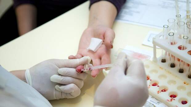 Что показывает общий анализ крови: расшифровка основных показателей