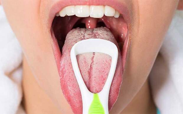 как очистить язык от налета фто