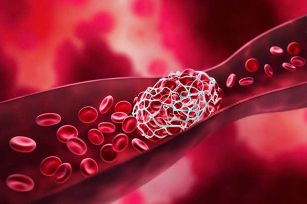 Смерть в прямом эфире: кардиолог указал на роковую ошибку, убивающую молодых