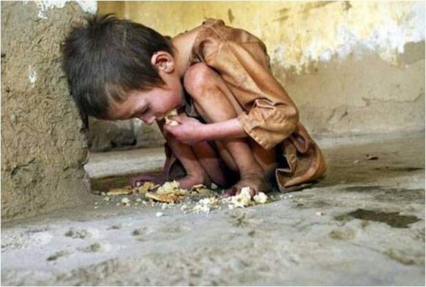 Голод как современная проблема человечества.
