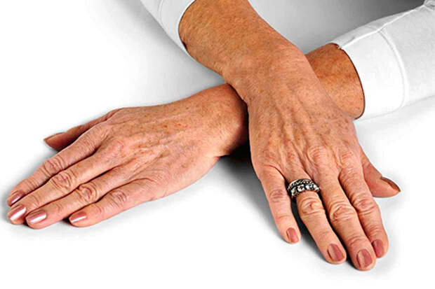 Как защитить руки от старения