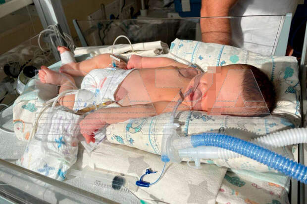 Baza: в Петербурге ребенок стал инвалидом после платных родов