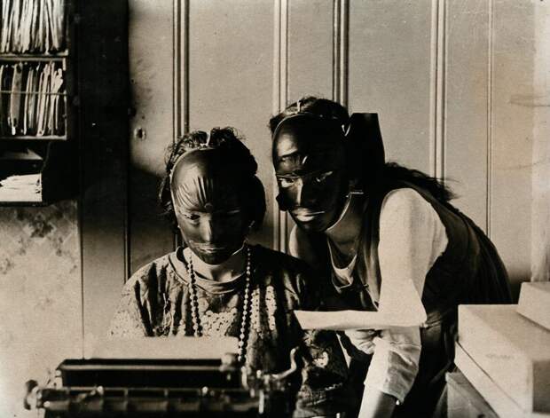 Вот такие резиновые маски использовали девушки в 1920, чтобы избавиться от морщин