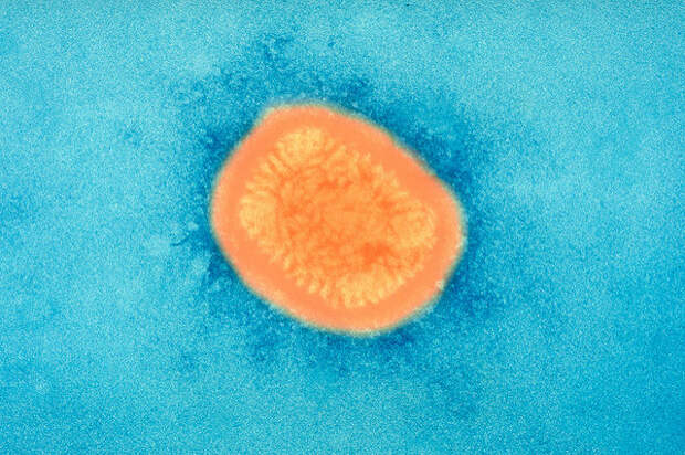 Вирус оспы под электронным микроскопом. (Фото Sanofi Pasteur / Flickr.com.) 