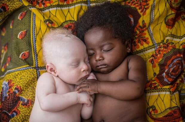 3-недельный младенец-альбинос прикорнул к своему двоюродному брату подборка фото, хорошие фото, эмоции