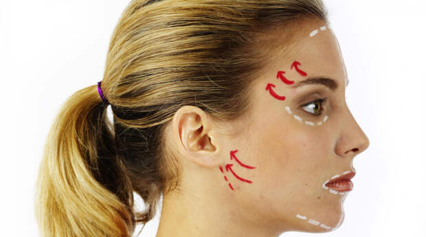 53-летняя женщина раскрыла неожиданные последствия неудачной пластики