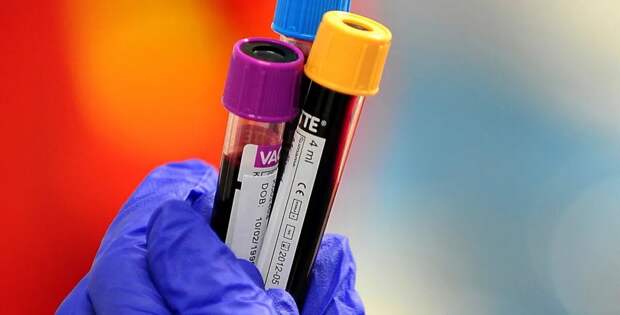 Новый анализ крови выявляет рак поджелудочной железы до того, как он станет смертельно опасным