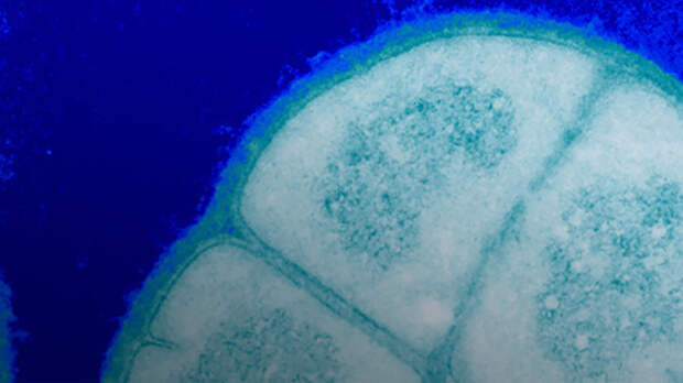 Грамположительный, экстремофильный кокк рода Deinococcus — один из самых устойчивых к действию ионизирующего излучения видов бактерий