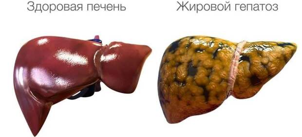 Что и как программирует вашу печень изнутри, создавая основу для рака?