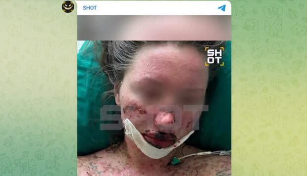 Москвичка едва не умерла из-за таблеток от депрессии