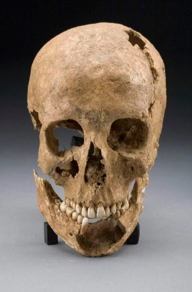 400 лет назад этого юношу убили индейцы. Перед смертью у него сильно болел зуб