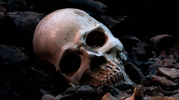Skull and bones