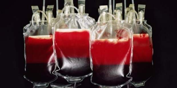 Впервые больному переливается искусственная кровь.