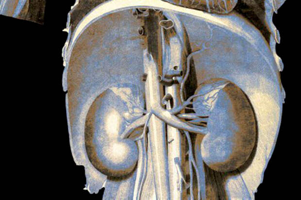 KIR: потеря памяти связана с ускоренным снижением функции почек