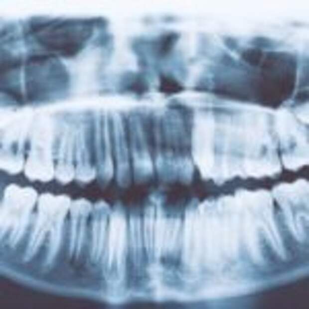 Индийский мальчик имеет 526 лишних зубов, как можно понять, что за болезнь