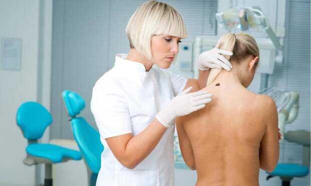 Заморозить, сжечь током и еще два способа удалить родинку — выбираем безопасный