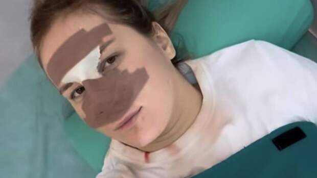 Россиянка сделала пластику под местной анестезией и назвала результат адом