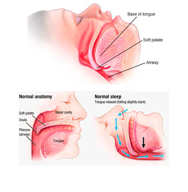 Как избавиться от храпа: несколько дельных советов