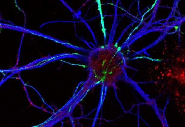 Кетамин культивирует новые соединения нервных клеток