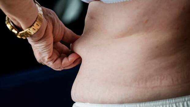 Американские ученые определили главную причину возникновения ожирения