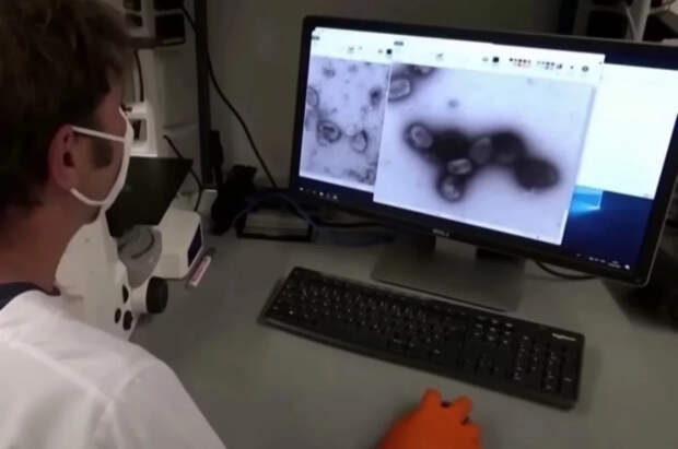 Оспу обезьян выявили лишь у одного из двух пациентов в Подмосковье