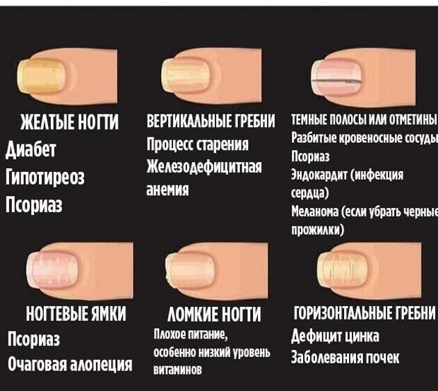 Что не так с ногтями Что не так с ногтями