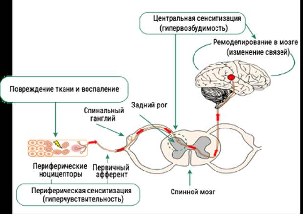 Механизм центральной и периферической сенситизации