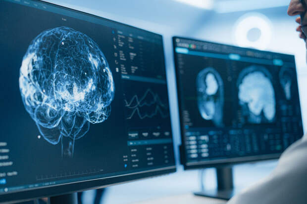 NBE:  особые иммунные клетки могут устранить метастазы рака в головном мозге