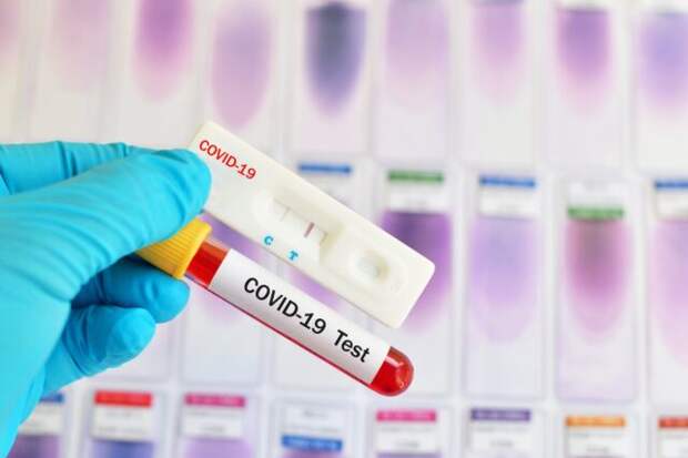 Где сделать тест на COVID-19 или на антитела в Ярославле?
