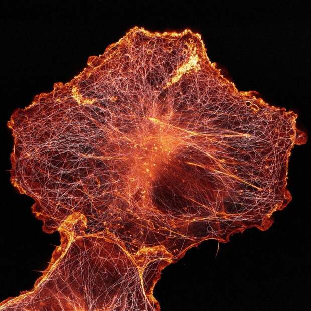 20 работ с конкурса микрофотографии Nikon Small World 2018