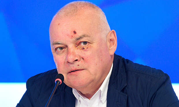 Журналист Дмитрий Киселев объяснил исцарапанное лицо и синяк под глазом заботой о маслинах в Крыму 