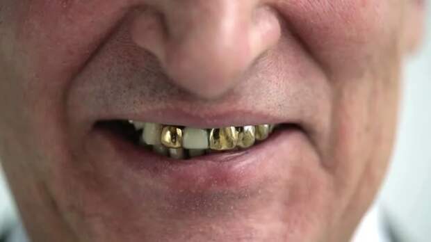 Золотые зубы были очень популярны в СССР среди отдельных категорий граждан. /Фото: ak.picdn.net