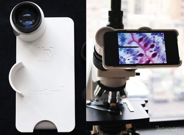 iPhone превратится в цифровой микроскоп благодаря iDu (3 фото + 2 видео)
