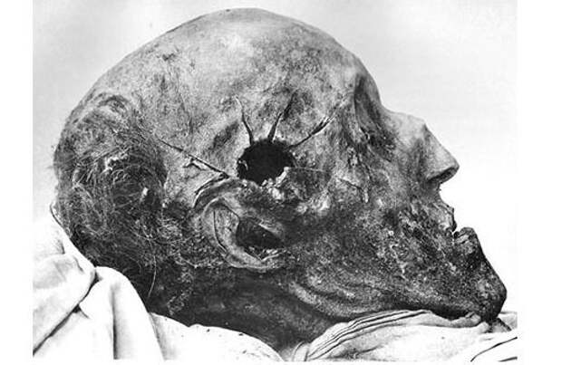 Тайна гибели короля Карла XII. Мумии и скелеты история, мумии, скелеты, тайны
