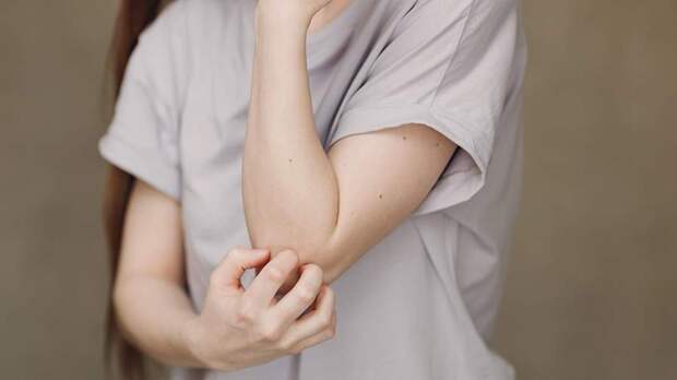 Эксперт рассказала об опасности укусов комаров