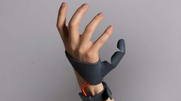 Дизайнер разработала протез шестого пальца
