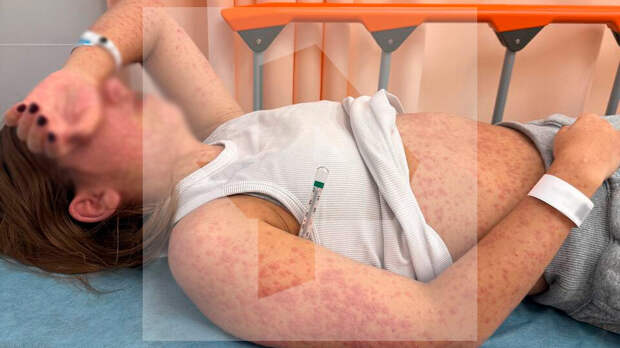 Школьница чуть не умерла от приема антидепрессантов, выписанных в частном центре