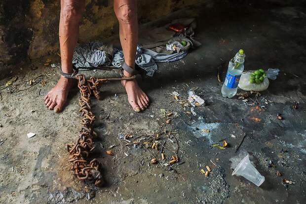 Психически больного китайца держали 17 лет на цепи в сарае