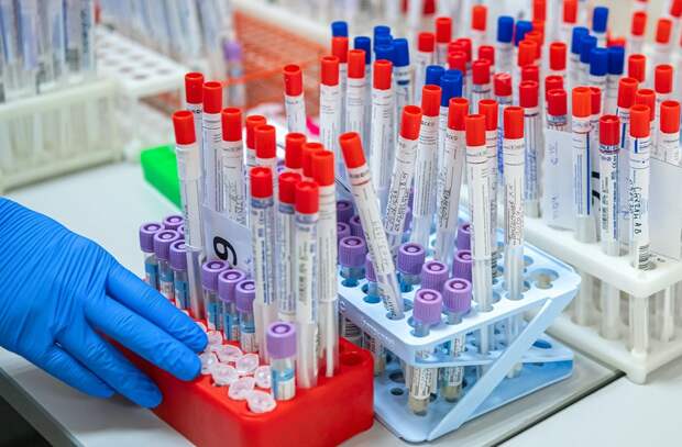 Иммунитет к COVID-19 уже формируется у 17,4% москвичей