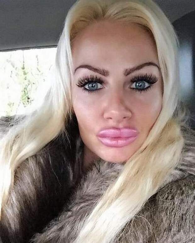 Женщина потратила 23 миллиона рублей на пластические операции, надеясь превратиться в живую Барби