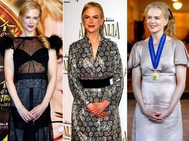 Nicole Kidman