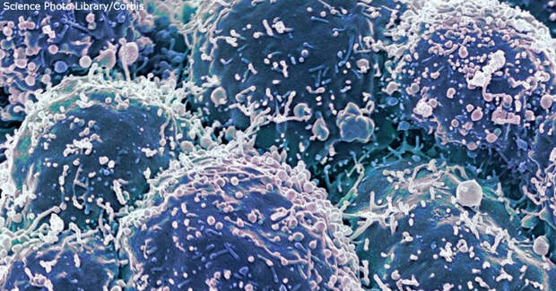 Почему ваша иммунная система играет ключевую роль в борьбе с раком