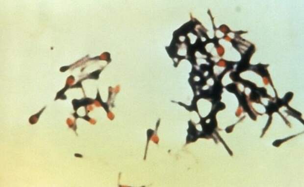 Столбнячная палочка Clostridium tetani