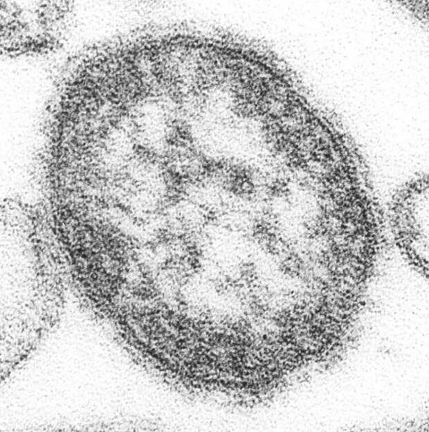Вирус кори Measles morbillivirus