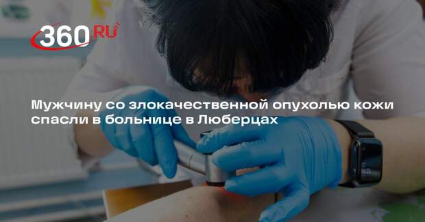 Мужчину со злокачественной опухолью кожи спасли в больнице в Люберцах